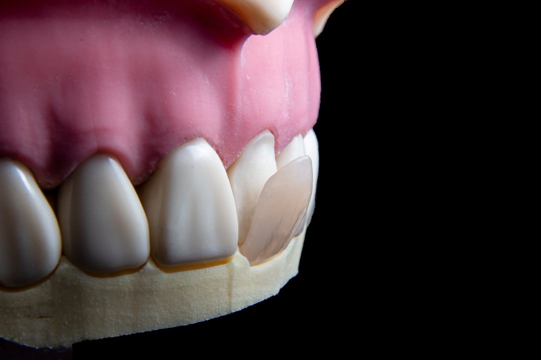 Facetas de resina antes e depois: a prova visual do que esperar do resultado.